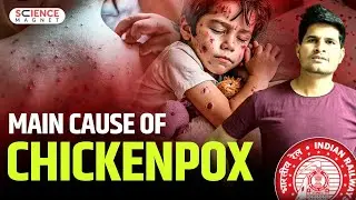 Main Couse of Chicken Pox | Railway Exams 2024-25 | Science by Neeraj Sir