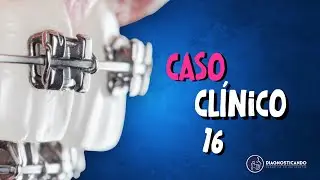 Caso Clínico 16- O caso mais complexo da Segunda Temporada !!!