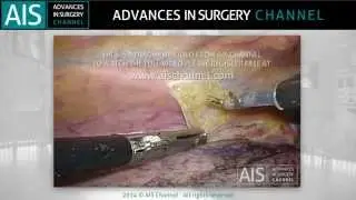 How to improve the visualization of the thoracic duct