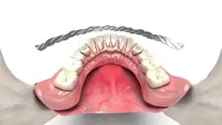 Применение Easy2Fix 