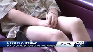 Measles outbreak