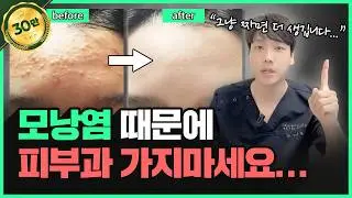 짜면 번지는 모낭염...😭 모낭염 & 여드름 구분법, 관리법 전부 공개! | 모냥염은 그냥 짜면 안돼요ㅠㅠ
