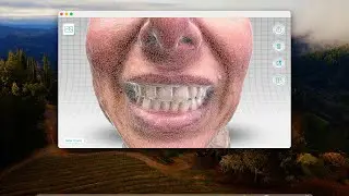 How to get a detailed 3D mesh in Qlone Face Scans for Dental CAD/CAM