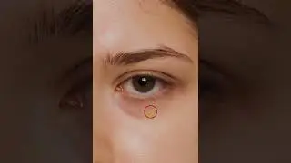 Remove Deep dark circles in Photoshop