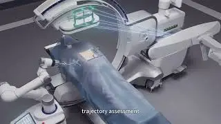 Perlove Medical's self-developed orthopedic surgical robot and 3D C-arm are a seamless combination.