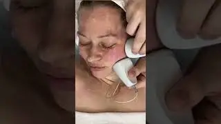 4 д омоложение лица без уколов и пластики