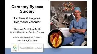 Coronary Artery Bypass Surgery (CABG) - Thomas A. Molloy, MD
