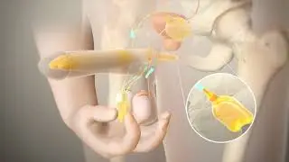 Penile Prosthesis Animation - Utah Men's Health