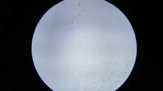 Focusing in on my Cheek Cells