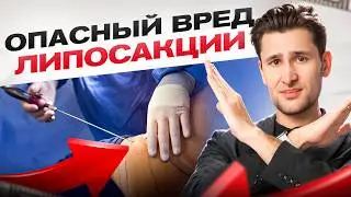 Скрытый ВРЕД ЛИПОСАКЦИИ - Хирурги об этом не говорят