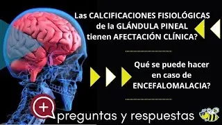 Preguntas y respuestas. Encefalomalacia, atrofia cerebral, calcificaciones cerebrales, radiación...
