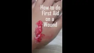 How To Do First Aid On a Wound