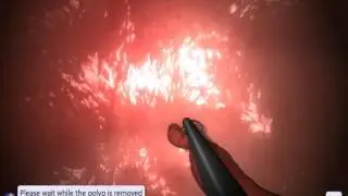 EndoSim Polypectomy Biopsy