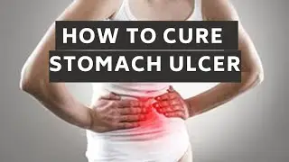HOW TO CURE STOMACH ULCER (How to fix a Stomach Ulcer)