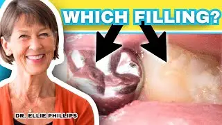 Should You Get A Silver Amalgam Filling (The Best Cavity Fillings For Teeth)