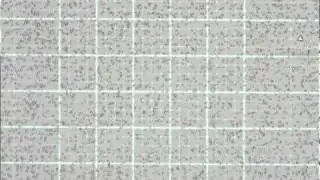 4 Red Cell Count:  Microscope Check