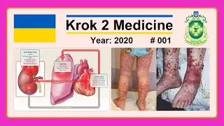 [ Krok 2 Medicine ] Year: 2020 - 001 (Ministry of Public Health of Ukraine)