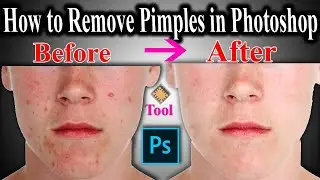 How to Remove Pimples in Photoshop cs6