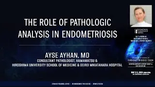 The role of pathologic analysis in endometriosis - Ayse Ayhan, MD