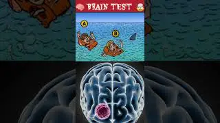 TEST YOUR BRAIN 🧠
