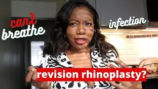 Infected nose job and Deviated septum |3 months rhinoplasty update