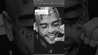 Mc Kevin tendo as tatuagens removidas 