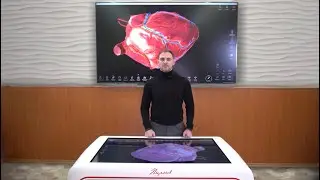 Анатомия коронарного кровоснабжения