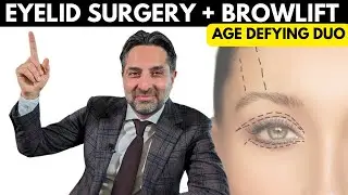 213 The Powerful AGE DEFYING Duo [Eyelid Surgery + Browlift] #eyelidsurgery #hooding #heavyeyelids