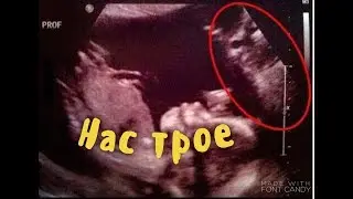 Теперь нас будет трое!