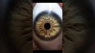 #eye #iris #photography