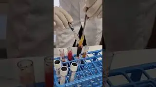 PRF (fibrina rica em plaquetas)