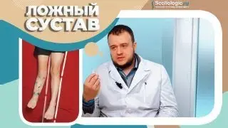 Ортезирование при псевдоартрозе или ложном суставе