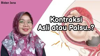 PERBEDAAN KONTRAKSI ASLI DAN PALSU SAAT HAMIL, BIDAN ISNA