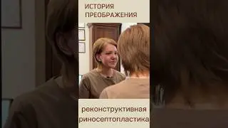 ИСТОРИЯ ПРЕОБРАЖЕНИЯ реконструктивная риносептопластика