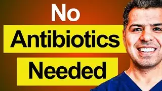 Avoid Prescribing Antibiotics in these conditions!