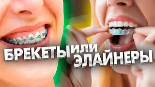 Лечение на элайнерах стоит дороже, чем на брекетах?