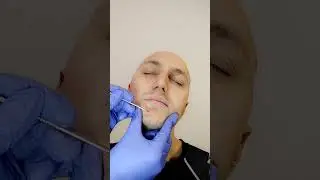 ЧИСТКА КОЖИ