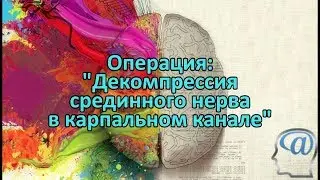 Операция. Эндоскопическая декомпрессия срединного нерва в области карпального канала. Нейрохирургия