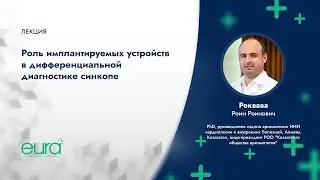 Роль имплантируемых устройств в дифференциальной диагностике синкопе