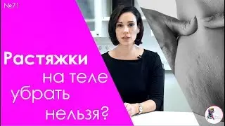 Растяжки на теле убрать нельзя?