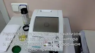 Экспресс-анализ мочи за 1 минуту. Урология анализы Киев.