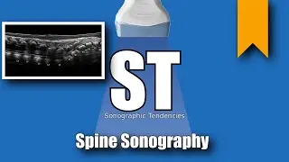Neonatal/Infant Spine Sonography