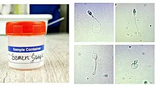 Semen Analysis Test Lab | Sperm Hypo Osmotic Swelling (HOS) Test Protocol