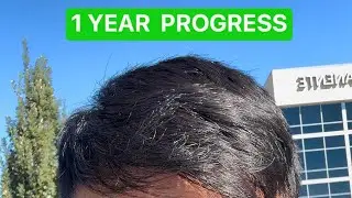 1 YEAR Update - Motion Hair Clinic