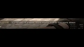 my down syndrome clips in csgo