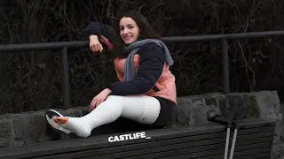 Camille very long leg pointed cast - her first, a lot of crutching