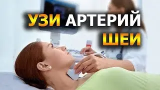 УЗД артерій шиї. Доплерографія судин шиї та головного мозку