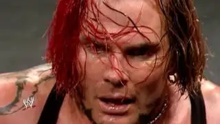 ►  Jeff Hardy Tribute ||  Gavin Rossdale 