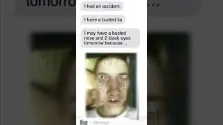 Amber Heard Threatens Johnny with ‘Broken Nose, 2 Black Eyes & Split Lip