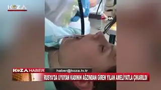A SNAKE THAT ENTERED A SLEEPING WOMAN'S MOUTH WAS REMOVED WITH SURGERY